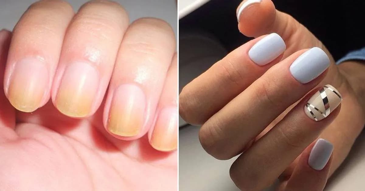 Jak usunąć przebarwienia na hybrydzie: 5 skutecznych metod Jak usunąć przebarwienia na hybrydzie: 5 skutecznych metod